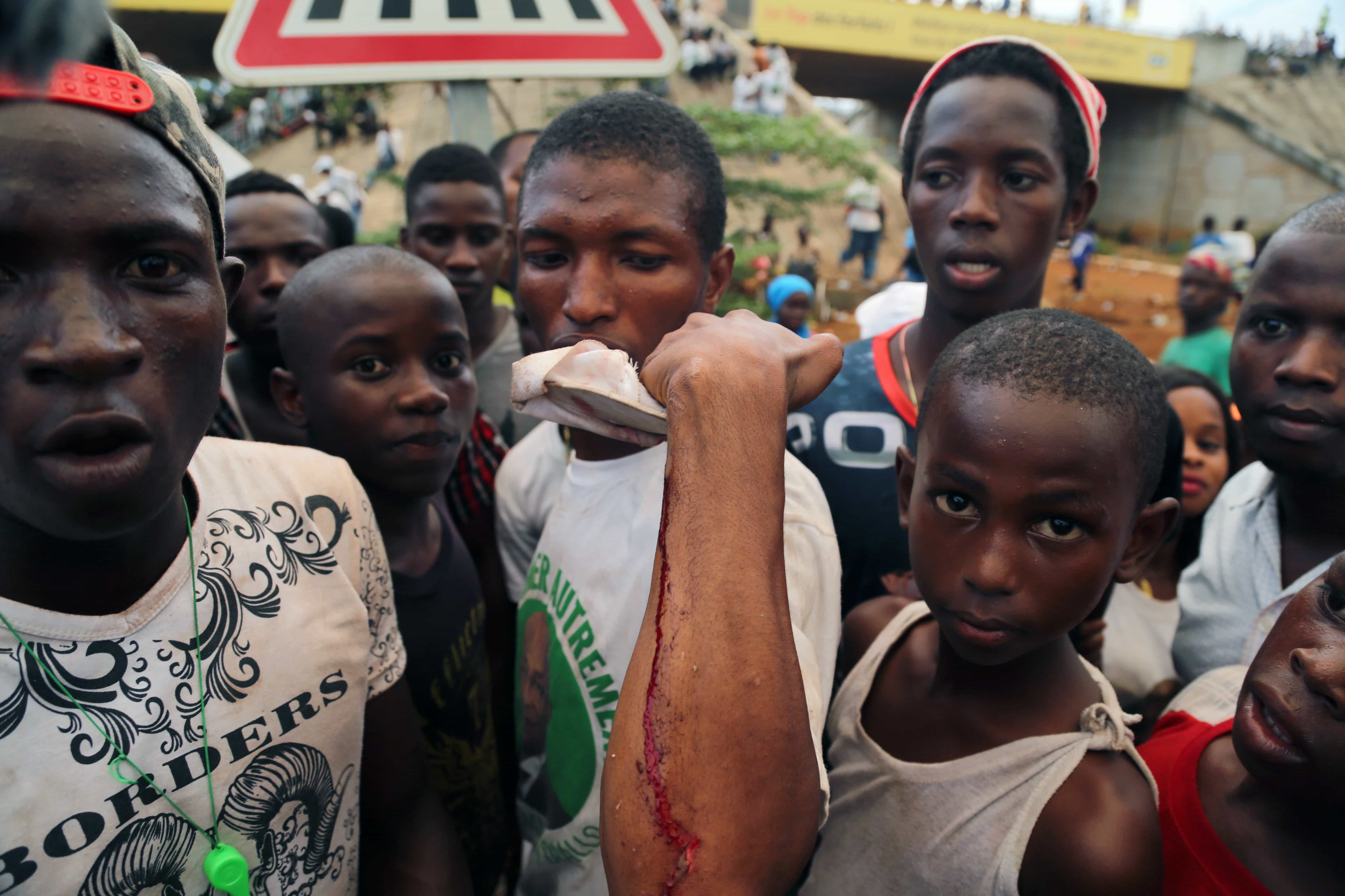 A man shows on his arm where he was injured at a rally in support of opposition presidential candidate Cellou Dalein Diallo in Conakry, Guinea, 8 October 2015., AP Photo/ Youssouf Bah
