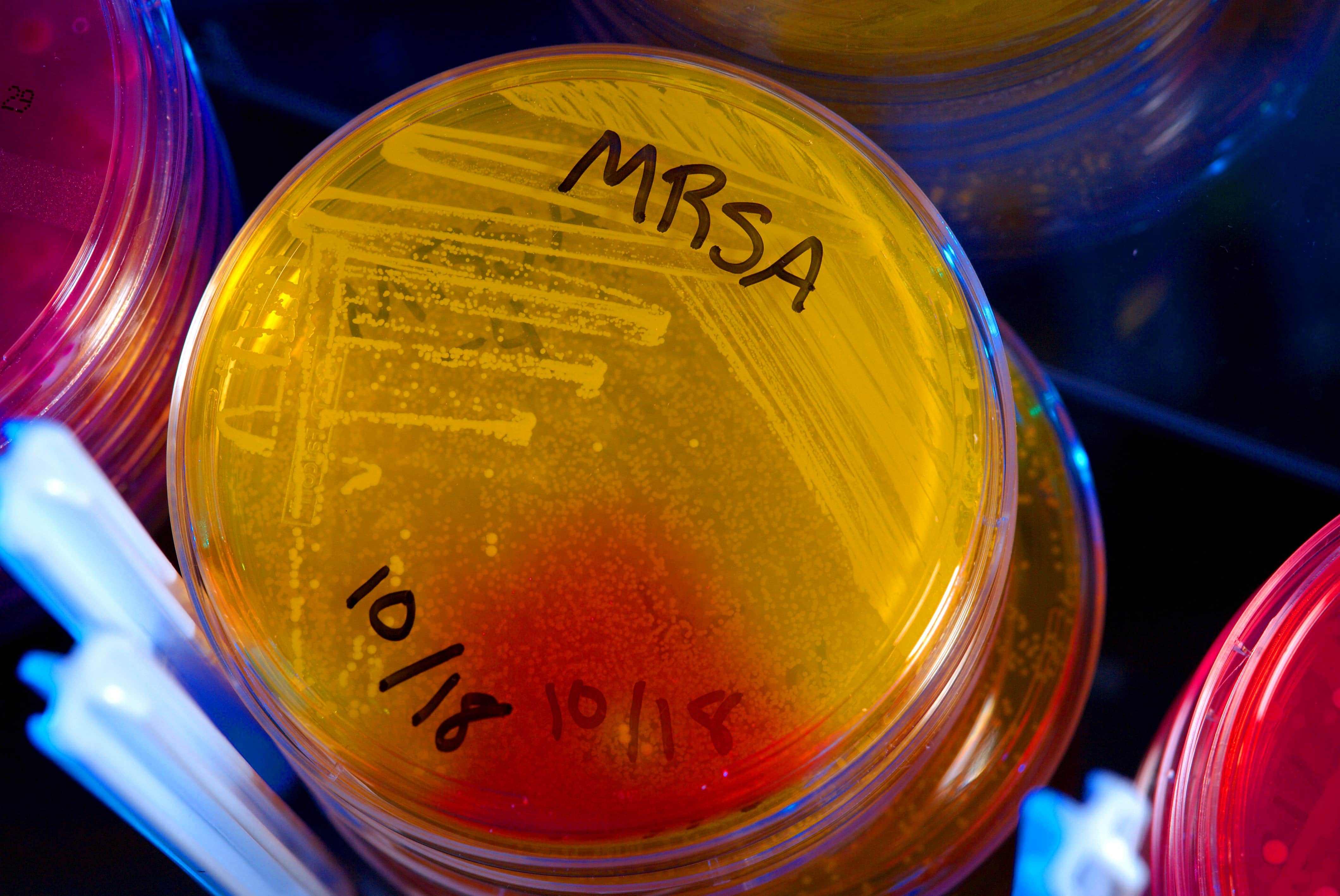 This undated photo provided by the Center for Disease Control (CDC) shows plates of Methicillin-Resistant Staphylococcus Aureus (MRSA)., AP Photo/Center for Disease Control
