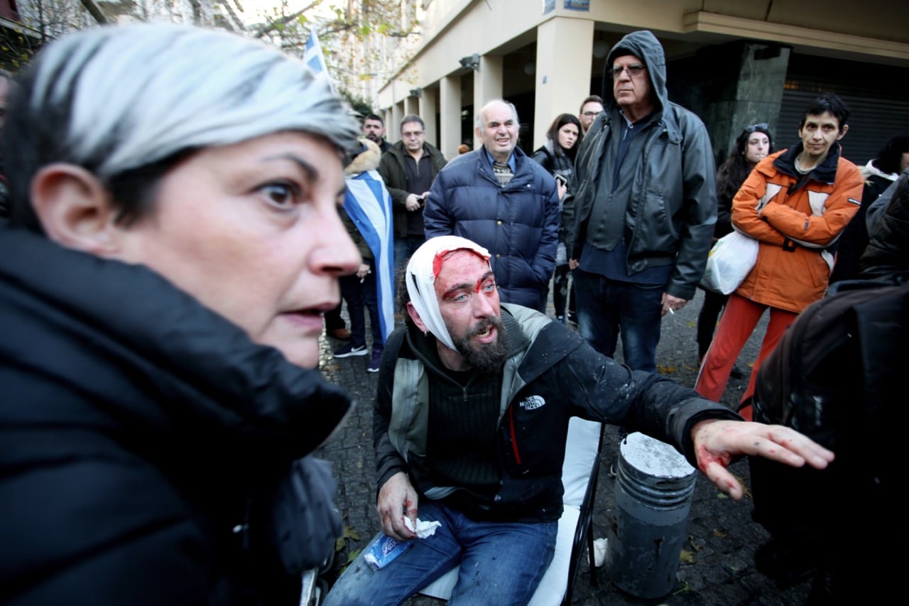 Photojournalist Kostas Dadamis seriously injured after an attack by far-right protesters during a demonstration in Syntagma square, Athens, Greece, 20 January 2019, Giorgos Georgiou/NurPhoto via Getty Images