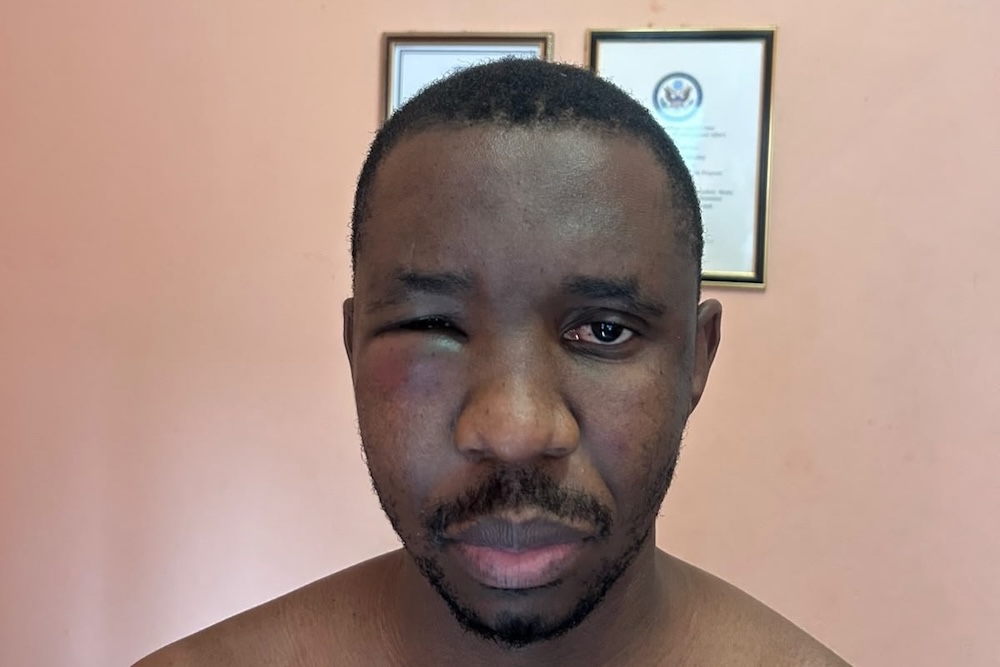 Editor, rights defender and former Chairperson of MISA Lesotho, Kananelo Boloetse, is violently abducted and threatened